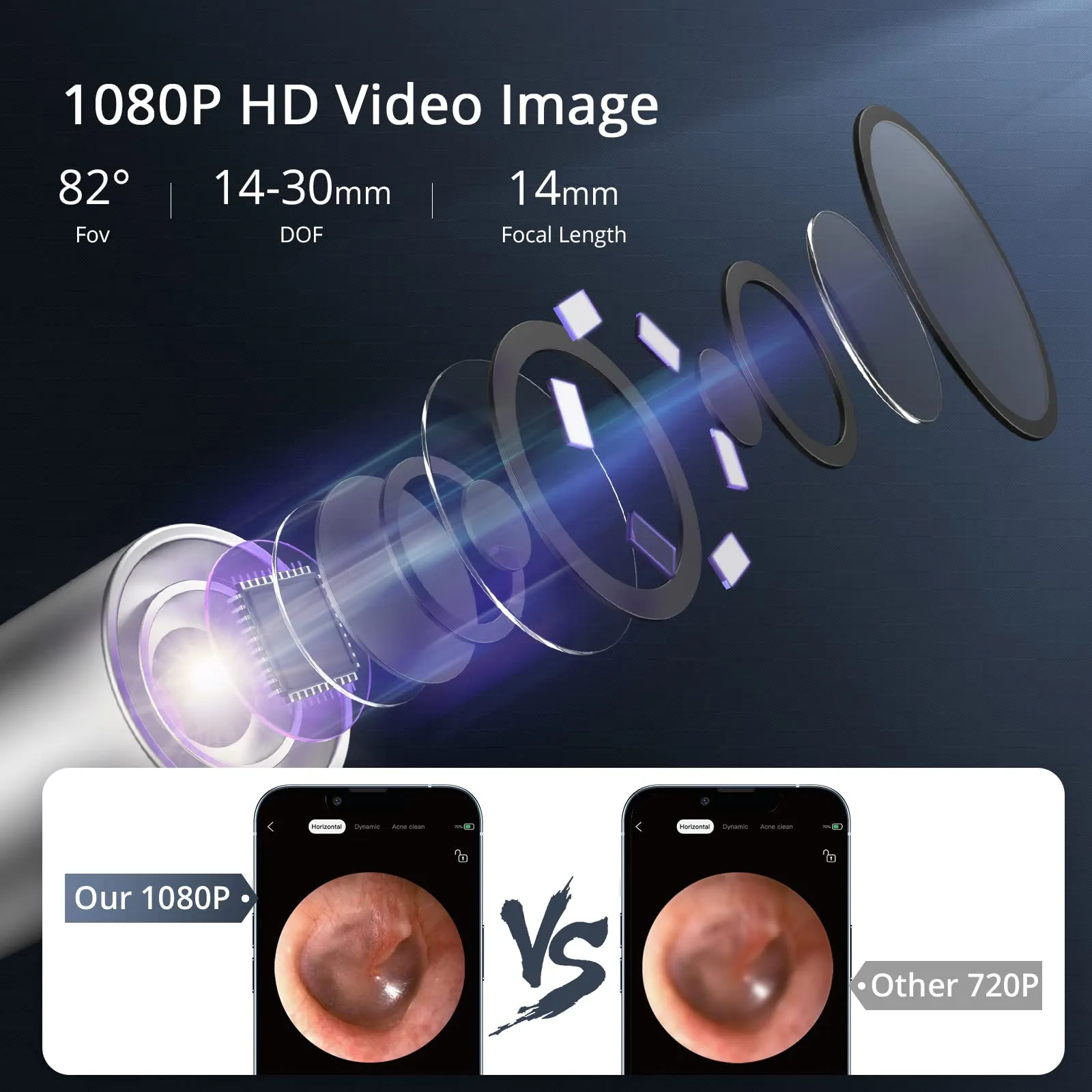 ACEKOOL Ear Wax Remover, 1080P FHD Wireless Ear Wax Removal Kit WiFi Ear Cleaner Camera with 6 LED Lights, 3.5mm Visual Ear Otoscope for Adults, Kids & Pets