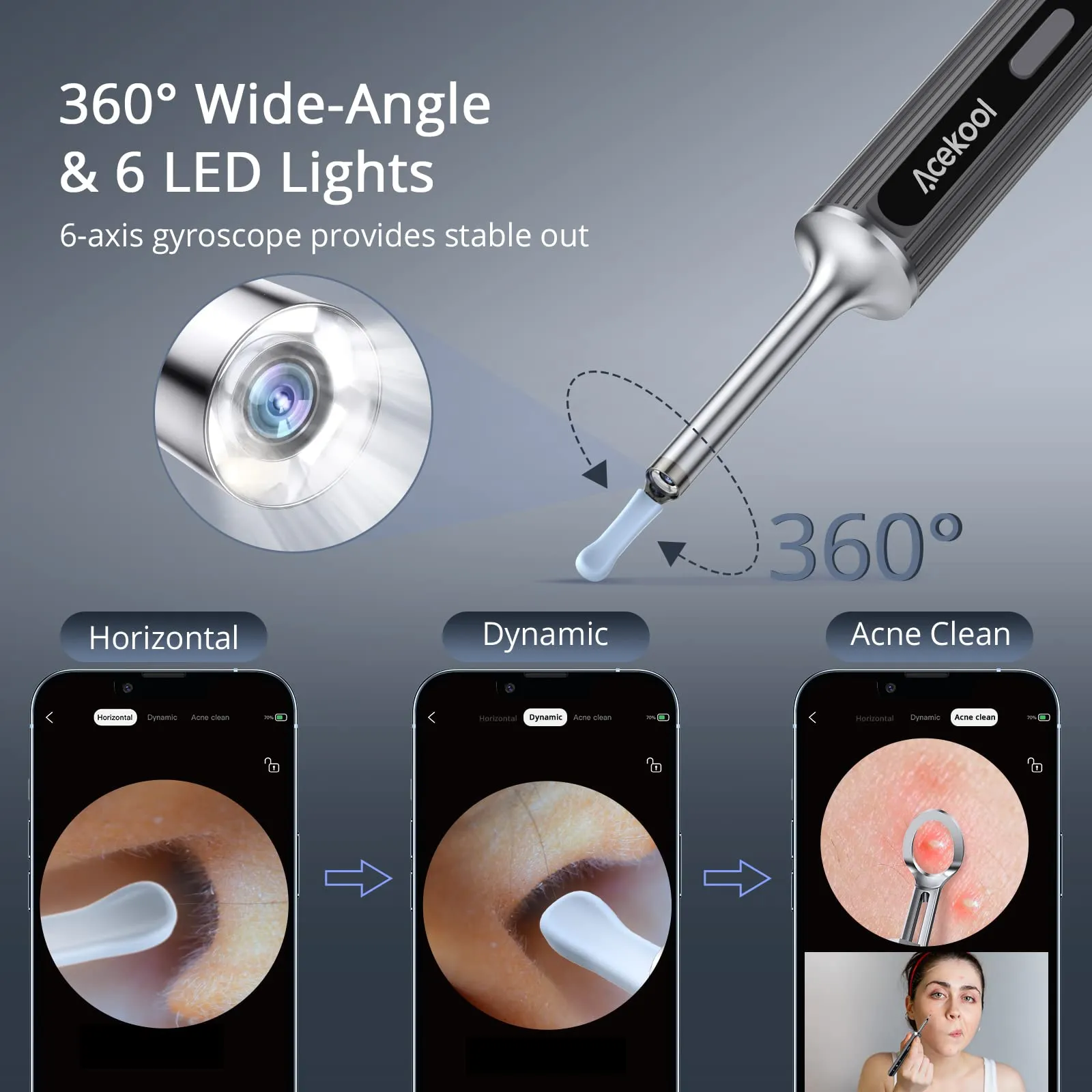 ACEKOOL Ear Wax Remover, 1080P FHD Wireless Ear Wax Removal Kit WiFi Ear Cleaner Camera with 6 LED Lights, 3.5mm Visual Ear Otoscope for Adults, Kids & Pets
